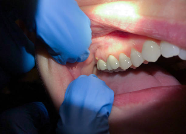 Best Tooth Pain Emergency Relief  in Cibecue, AZ